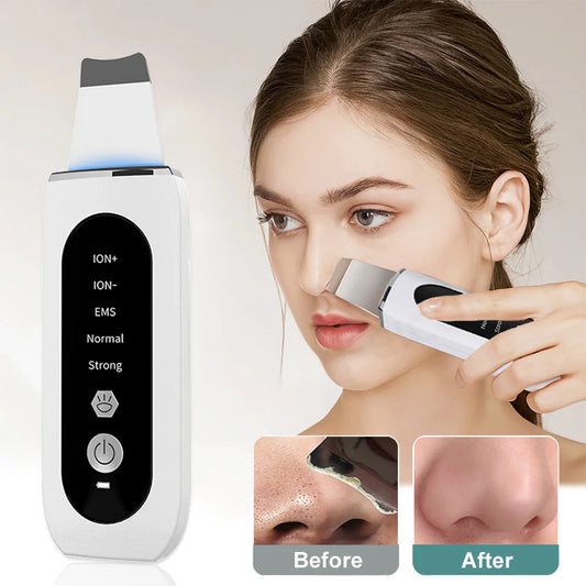 Ultrasonic Blackhead Remover & Skin Rejuvenation Device
